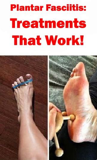Fast And Effective Solution For Painful Heels Plantar