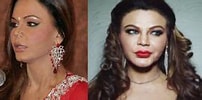 Image result for Rakhi Sawant Before and After Surgery. Size: 202 x 99. Source: sekho.in