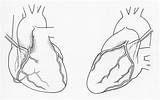 Coronary Arteries Anatomy 14th sketch template