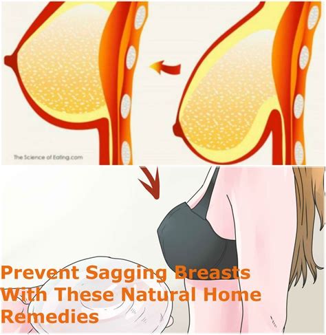 remedies clinic revent sagging breasts with these natural