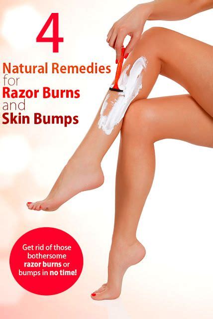 4 Natural Remedies For Razor Burns And Skin Bumps Get Rid Of Razor