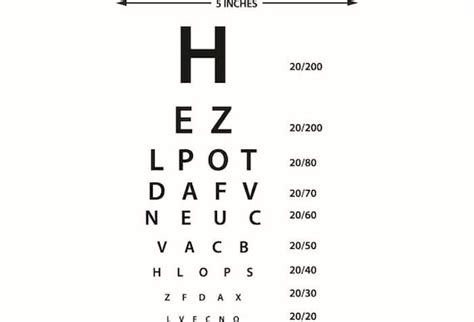 eye chart doctor optometrist ophthalmologist problem disease