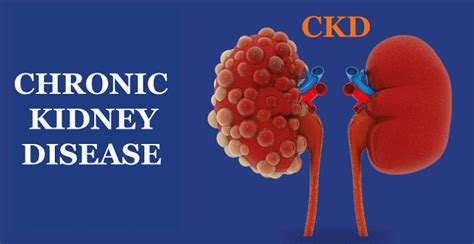 ckd full form chronic kidney disease javatpoint