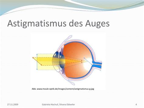 astigmatismus powerpoint    id