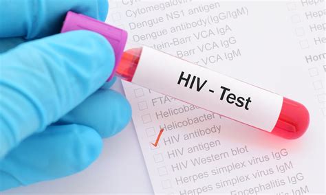 Cure For Hiv Aids Sex Based Treatment Will Work As Hiv Is