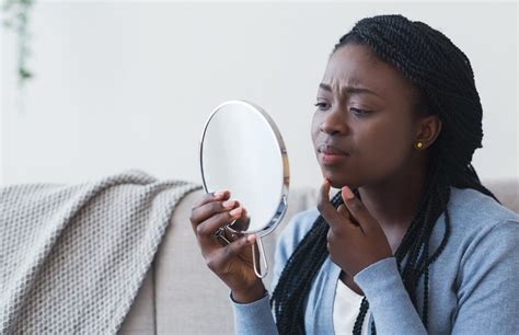 black dermatologist explains   clear   stubborn dark