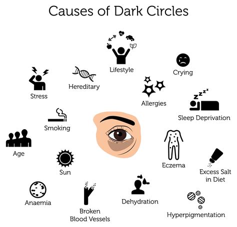 dark circles treatment  london rejuvence clinic