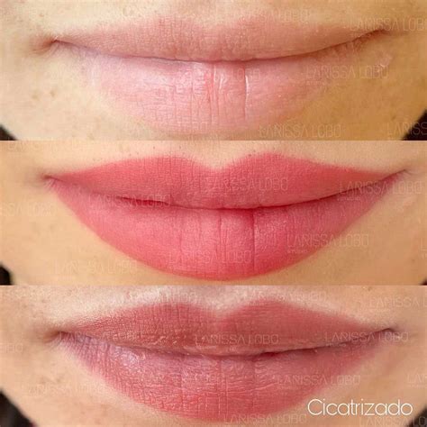 Explore The Best Lip Blushing Before And After Pictures See Examples
