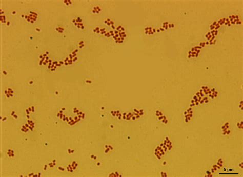 Miniatlas Mikroorganismů