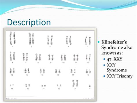 Ppt Klinefelters Syndrome Powerpoint Presentation Free Download