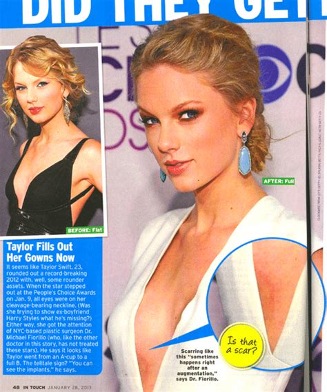 oh really taylor swift gets breast implant