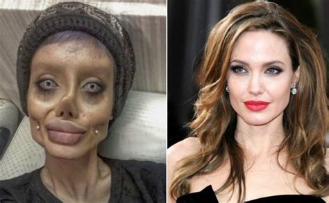 plastic surgery gone wrong porn star edition porn dude
