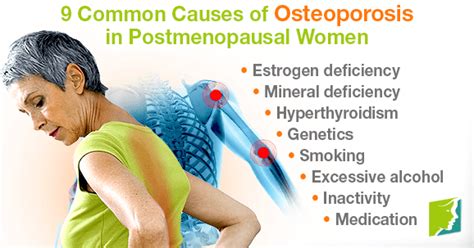9 common causes of osteoporosis in postmenopausal women