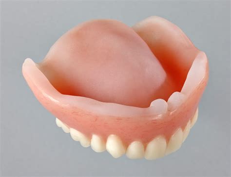 permanent soft liners parada dentures