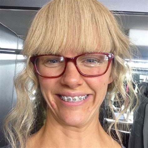See Brooklyn Decker With Pimples Braces And Nerd Glasses