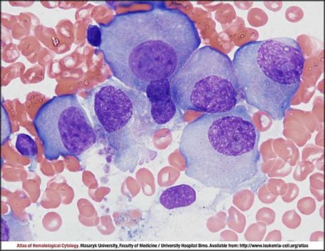 plasma cell myeloma cell atlas  haematological cytology
