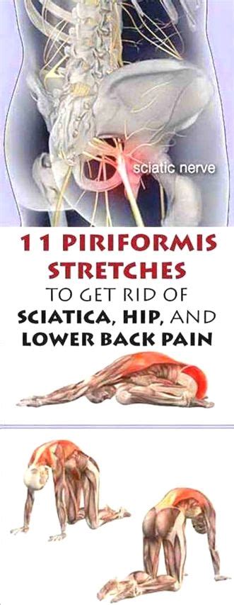 Pin On Sciatic Pain
