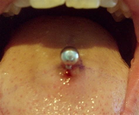 infected tongue piercing signs and symptoms causes