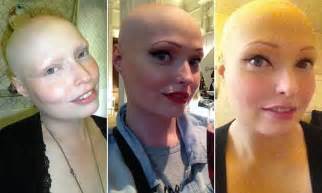 brenda finn left completely bald by alopecia on bully hell before £300