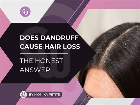 Does Dandruff Cause Hair Loss The Honest Answer