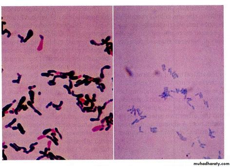 Cornyebacterium Diphtheriae Pptx د غادة يونس Muhadharaty