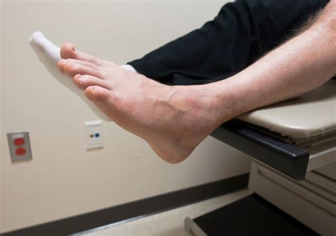 loma linda foot  ankle center loma linda ca podiatrists mapquest