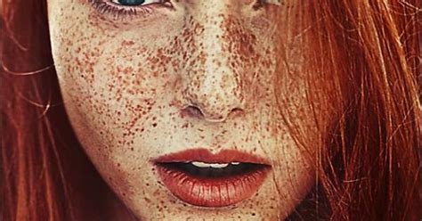 Freckles Are Damn Sexy Album On Imgur