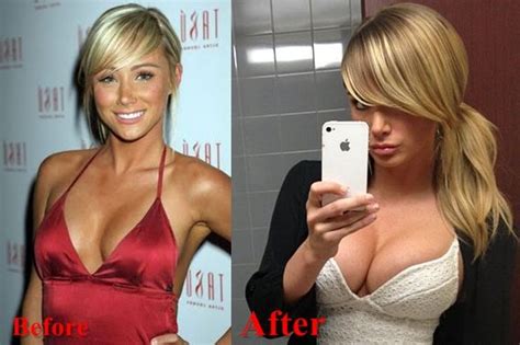 sara jean underwood breasts implants surgery before and after boobs job photos breast implant