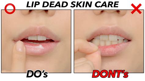 How To Care Of The Dead Skin On The Lips Chapped Lip Care Lip Scrub