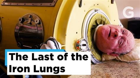 The Last Few Polio Survivors Last Of The Iron Lungs Gizmodo Youtube