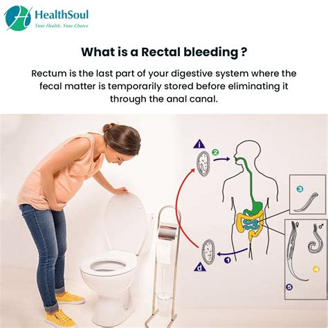 Rectal Bleeding Causes And Treatment Healthsoul