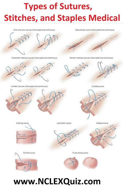 types  sutures stitches  staples medical nclex quiz