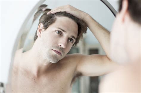 10 Signs You Will Go Bald How To Spot Them Before It’s Too Late