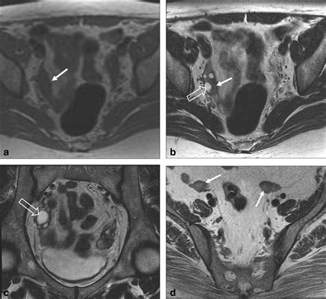 mri  ovarian masses vargas  journal  magnetic resonance imaging wiley  library