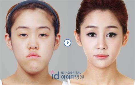 graduates in china are having plastic surgery to look perfect for job