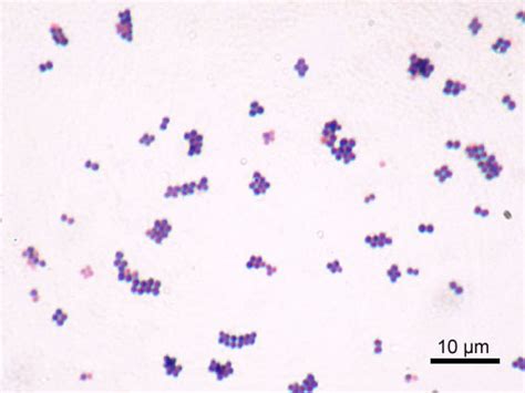 Photo Gallery Of Pathogenic Bacterial