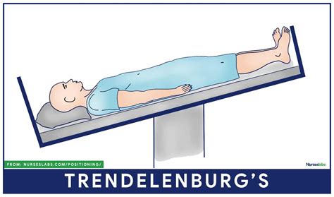 put  patient  reverse trendelenburg position anyang