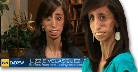 lizzie velasquez answers bullies who branded her the