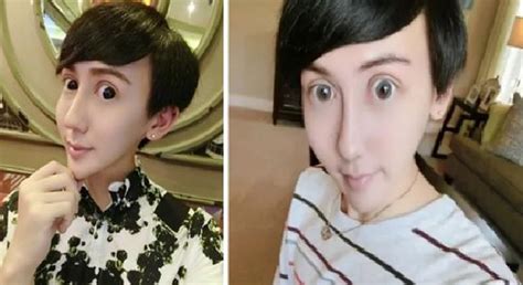 chinese girl undergoes intense plastic surgery claims herself to be beautiful world of buzz