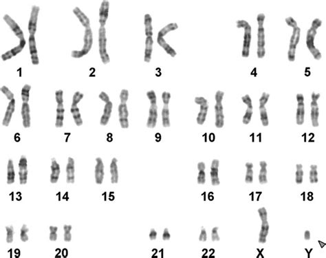 What Are 23 Pairs Of Chromosomes Quora