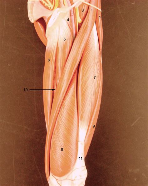 anatomy lab photographs  limb muscles