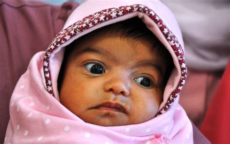 newborn operated  rare congenital disorder news emirates