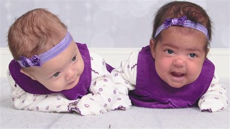 Twins Born With Different Skin Tones Aol News