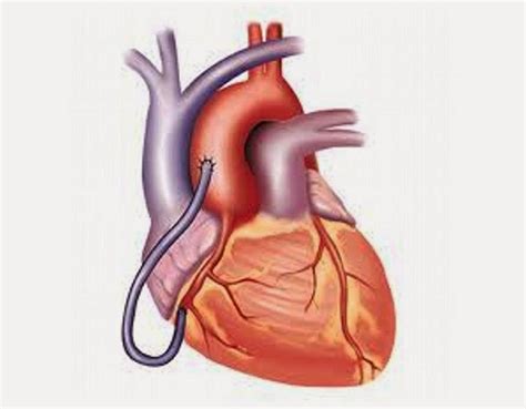 kebiasaan melindungi jantung obat sakit