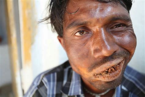 photos meet indian man addicted to eating mud bricks and rocks