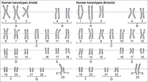 Karyotyping Current Perspectives In Diagnosis Of Chromosomal Disorders