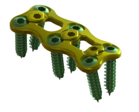 axis  plate spine