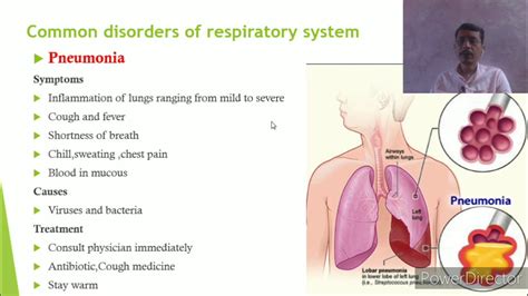 Common Disorders Of Respiratory System Youtube