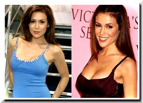 Alyssa Milano One Of The Sexiest Woman In The World Undergoes Plastic