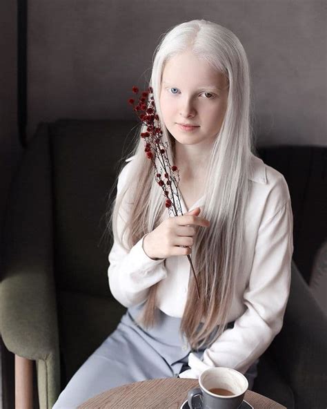 stunning portraits of 11 year old girl with albinism and heterochromia